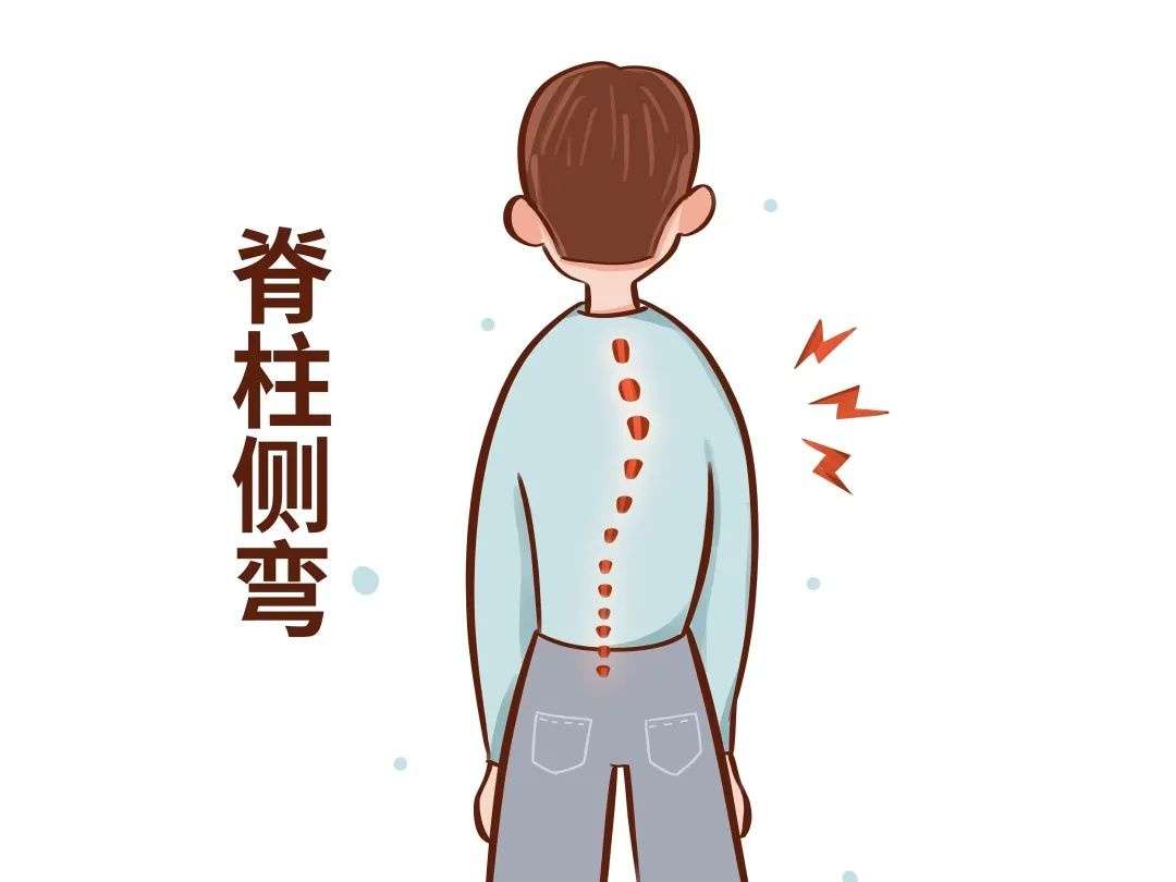 孩子得了脊柱侧弯能矫正过来吗?