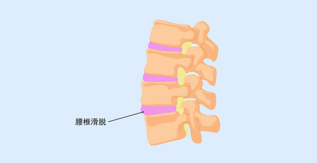 ����������ѵ��������