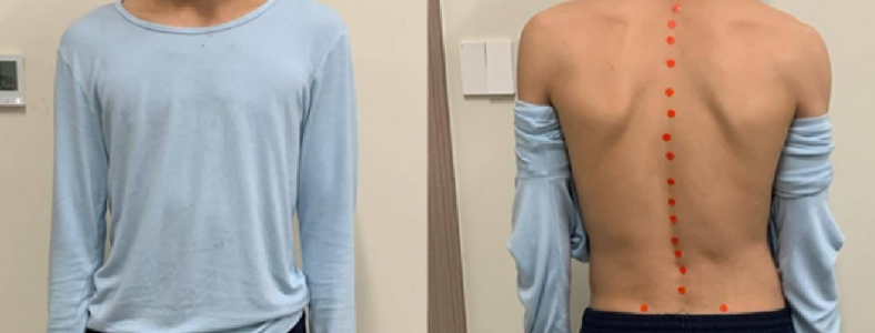 ��������20���ʲô��