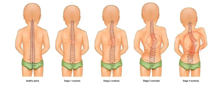 ���¼��������ԭ������Щ