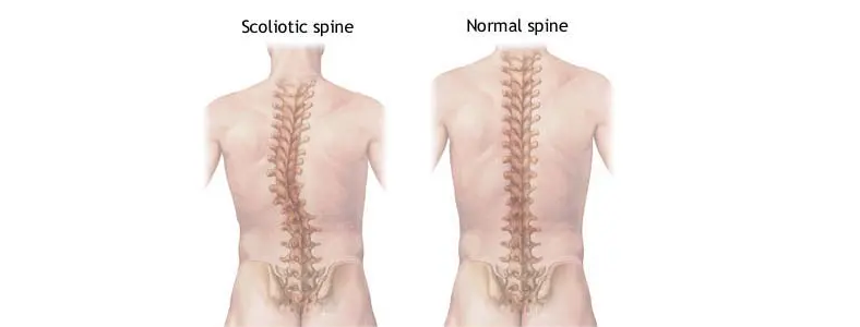 �������ط��Լ�����͹����