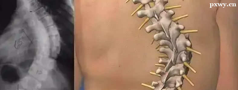 �����꼹������������ô�Ŷ���