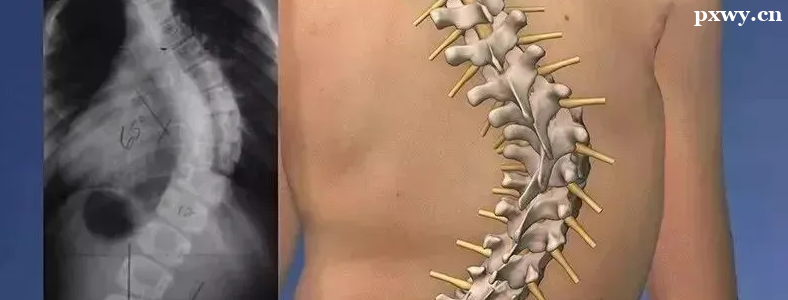 ���������ض���ʲô���