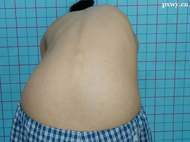 �������������֢״��������Щ