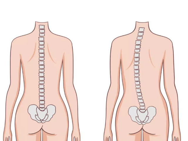 Ԥ�������꼹������ķ���